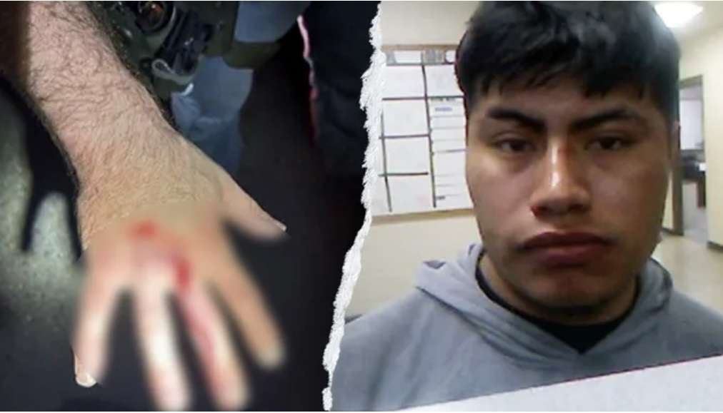 ICE officer bitten during arrest