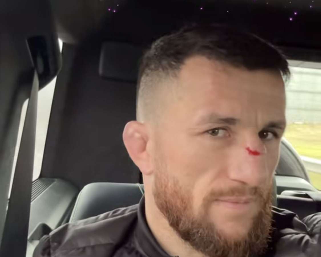 Merab Dvalishvili’s Nose Scar